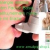 27358-01-alergie-na-roztoce-alergie-lenka.jpg